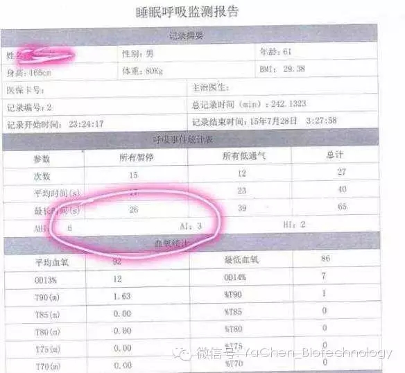 鼾克中频治疗仪成功病例分析4