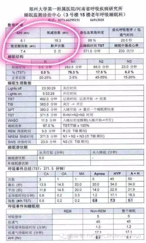 鼾克中频治疗仪成功病例分析3